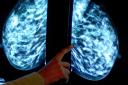 Uptake of NHS breast cancer screening in England was below target for the fourth year in a row, new figures have revealed (Rui Vieria/PA)