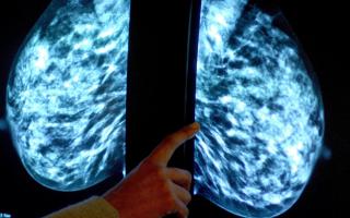 Uptake of NHS breast cancer screening in England was below target for the fourth year in a row, new figures have revealed (Rui Vieria/PA)
